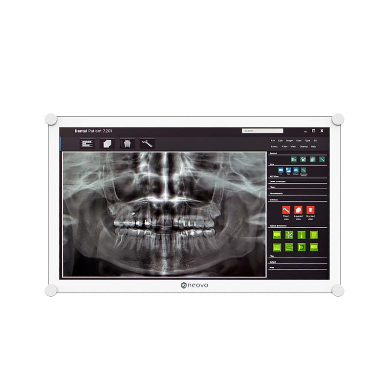 AG Neovo 22" LED Widescreen VGA/HDMI/DP Metal case Hard Glass White Monitor with DC 12v Medical Grade PSU